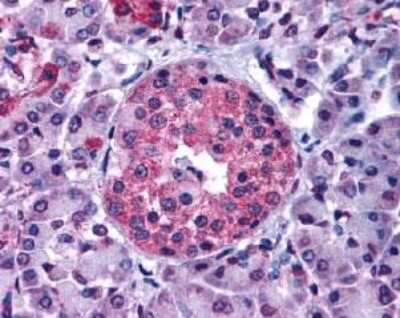 Immunohistochemistry-Paraffin: GIPR Antibody - BSA Free [NLS3840]