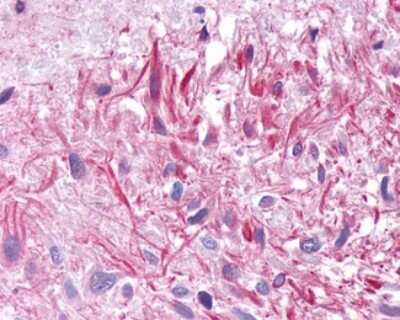 Immunohistochemistry-Paraffin: GIPR Antibody - BSA Free [NLS3842]
