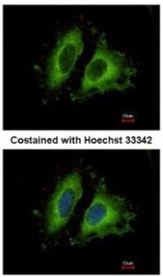 Immunocytochemistry/ Immunofluorescence: GIT1 Antibody [NBP1-31447]