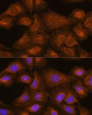 Immunocytochemistry/ Immunofluorescence: GIT1 Antibody - Azide and BSA Free [NBP3-03734]