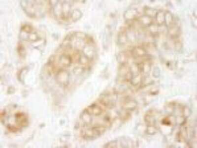 Immunohistochemistry-Paraffin: GIT1 Antibody [NBP1-19141]