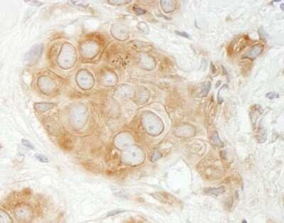Immunohistochemistry-Paraffin: GIT1 Antibody [NBP1-19141]