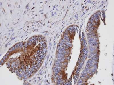 Immunohistochemistry-Paraffin: GIT1 Antibody [NBP1-31447]