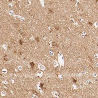 Immunohistochemistry-Paraffin: GIT1 Antibody [NBP1-85798]