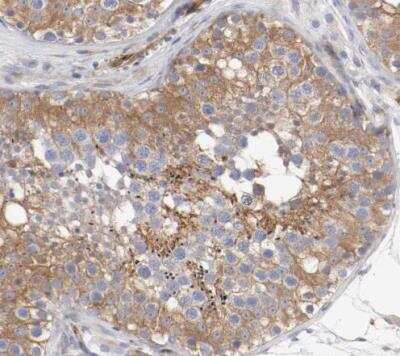 Immunohistochemistry-Paraffin: GIT1 Antibody [NBP1-86144]
