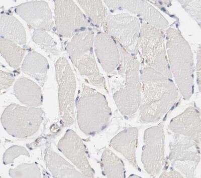Immunohistochemistry-Paraffin: GIT1 Antibody [NBP1-86144]