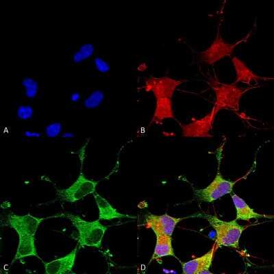 Immunocytochemistry/ Immunofluorescence: GIT1 Antibody (S39B-8) [NBP2-22423]