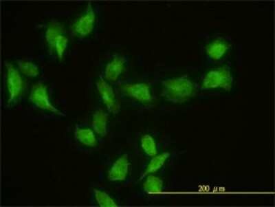 Immunocytochemistry/ Immunofluorescence: GIT2 Antibody (3B5-B9) [H00009815-M01]