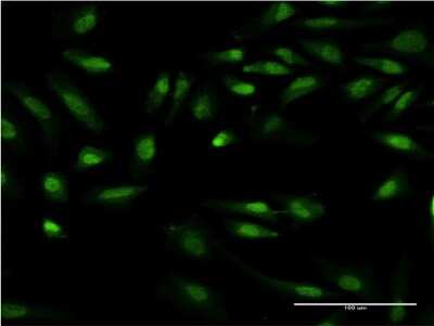 Immunocytochemistry/ Immunofluorescence: GIT2 Antibody (M1) [H00009815-M03]