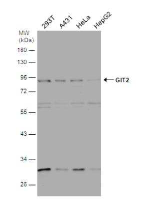 Western Blot: GIT2 Antibody [NBP2-16661]