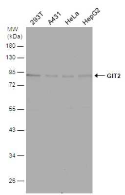 Western Blot: GIT2 Antibody [NBP3-13188]