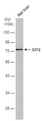 Western Blot: GIT2 Antibody [NBP3-13188]