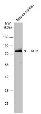 Western Blot: GIT2 Antibody [NBP3-13188]