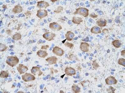 Immunohistochemistry: GITR/TNFRSF18 Antibody [NBP1-79933]