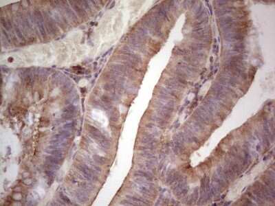 Immunohistochemistry: GITR/TNFRSF18 Antibody (OTI9G8) - Azide and BSA Free [NBP2-71388]