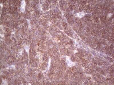 Immunohistochemistry: GITR/TNFRSF18 Antibody (OTI9G8) - Azide and BSA Free [NBP2-71388]