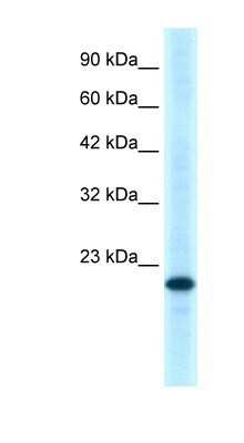 Western Blot: GITR/TNFRSF18 Antibody [NBP1-79933]