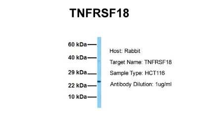 Western Blot: GITR/TNFRSF18 Antibody [NBP1-79933]