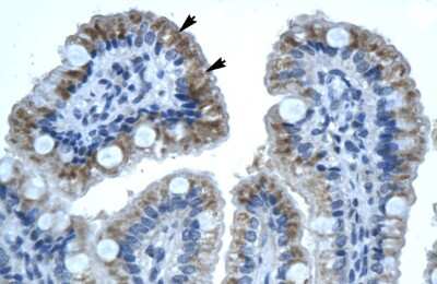 Immunohistochemistry-Paraffin: Connexin 32/GJB1 Antibody [NBP1-59139]