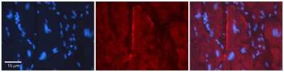 Immunohistochemistry: GJC2 Antibody [NBP1-59263]