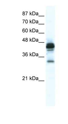Western Blot: GJC3 Antibody [NBP1-59162]