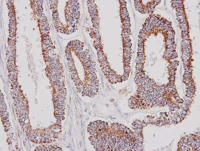 Immunohistochemistry-Paraffin: GK2 Antibody [NBP1-32210]