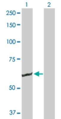 Western Blot: GK2 Antibody [H00002712-B01P]