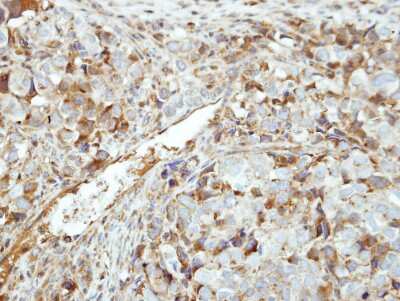 Immunohistochemistry-Paraffin: GK5 Antibody [NBP1-32863]