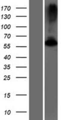 Western Blot: GK5 Overexpression Lysate [NBP2-08577]