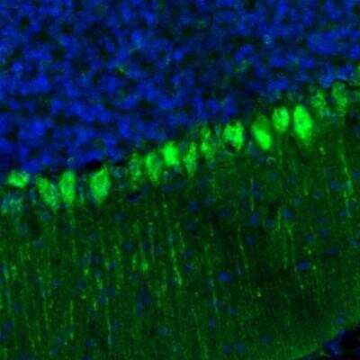 Immunohistochemistry: GKAP1 Antibody [NBP2-33989]