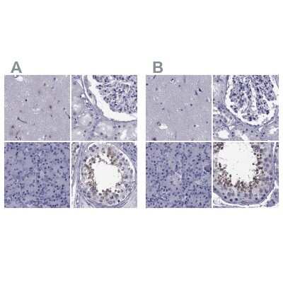 Immunohistochemistry-Paraffin: GKAP1 Antibody [NBP1-84669]