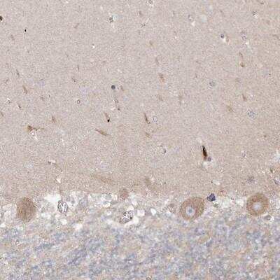 Immunohistochemistry-Paraffin: GKAP1 Antibody [NBP2-33989]