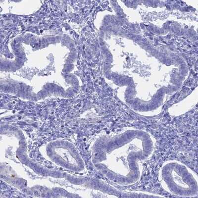 Immunohistochemistry-Paraffin: GLB1L Antibody [NBP1-81235]