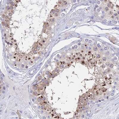 Immunohistochemistry-Paraffin: GLB1L Antibody [NBP1-81235]