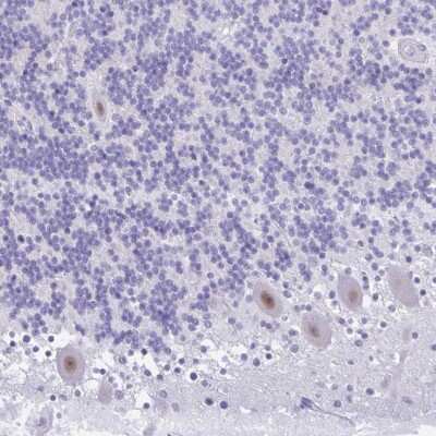 Immunohistochemistry: GLB1L2 Antibody [NBP2-31585]