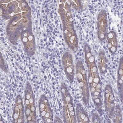 Immunohistochemistry-Paraffin: GLB1L2 Antibody [NBP2-31804]