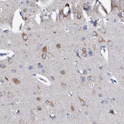 Immunohistochemistry: GLB1L3 Antibody [NBP2-48716]