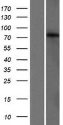 Western Blot: GLB1L3 Overexpression Lysate [NBP2-08486]