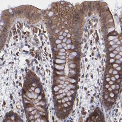 Immunohistochemistry-Paraffin: GLCCl1 Antibody [NBP1-87939]