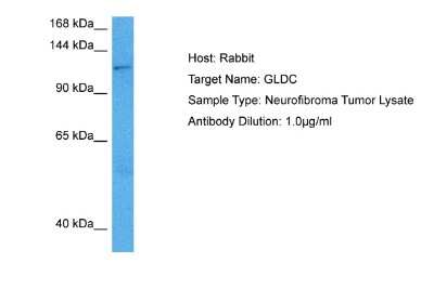 Western Blot: GLDC Antibody [NBP2-87504]