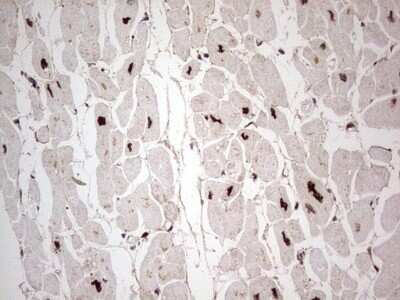 Immunohistochemistry: GLI-1 Antibody (OTI4E2) [NBP2-45872]