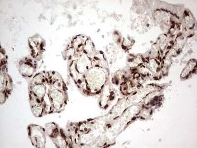 Immunohistochemistry: GLI-1 Antibody (OTI4E2) [NBP2-45872]