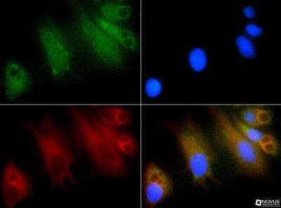 Immunocytochemistry/ Immunofluorescence: GLI-1 Antibody - BSA Free [NBP1-78259]