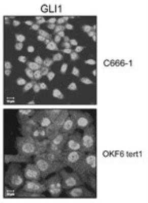 Immunocytochemistry/ Immunofluorescence: GLI-1 Antibody [NBP2-24662]