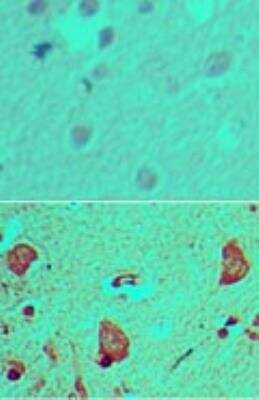 Immunohistochemistry-Paraffin: GLI-1 Antibody [NBP2-24662]