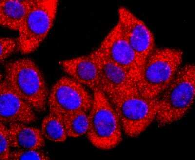 Immunocytochemistry/ Immunofluorescence: GLI-1 Antibody (JF09-08) [NBP2-66867]