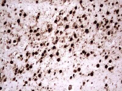 Immunohistochemistry: GLI-1 Antibody (OTI4E2) - Azide and BSA Free [NBP2-70831]