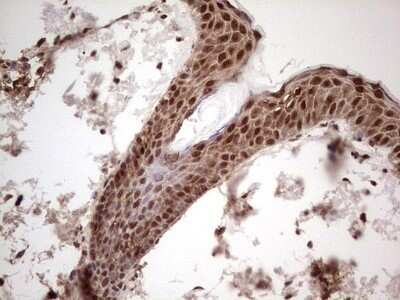 Immunohistochemistry: GLI-1 Antibody (OTI4E2) - Azide and BSA Free [NBP2-70831]