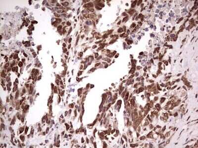 Immunohistochemistry: GLI-1 Antibody (OTI4E2) - Azide and BSA Free [NBP2-70831]