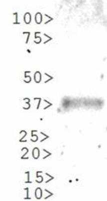 Western Blot: GLI-1 AntibodyBSA Free [NBP1-78259]